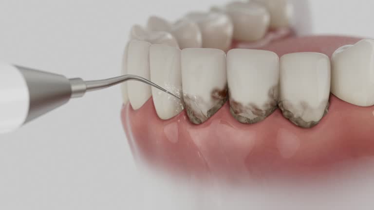 Reliable Dental contractor in Clemson University, SC by Dentist Open Now